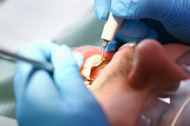 Best After-Hours Emergency Dentist in James Island, SC