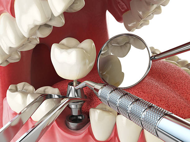 Best Emergency Treatment for Toothache in James Island, SC